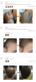 Sevich Hair Line Powder / Black Root Cover Up
